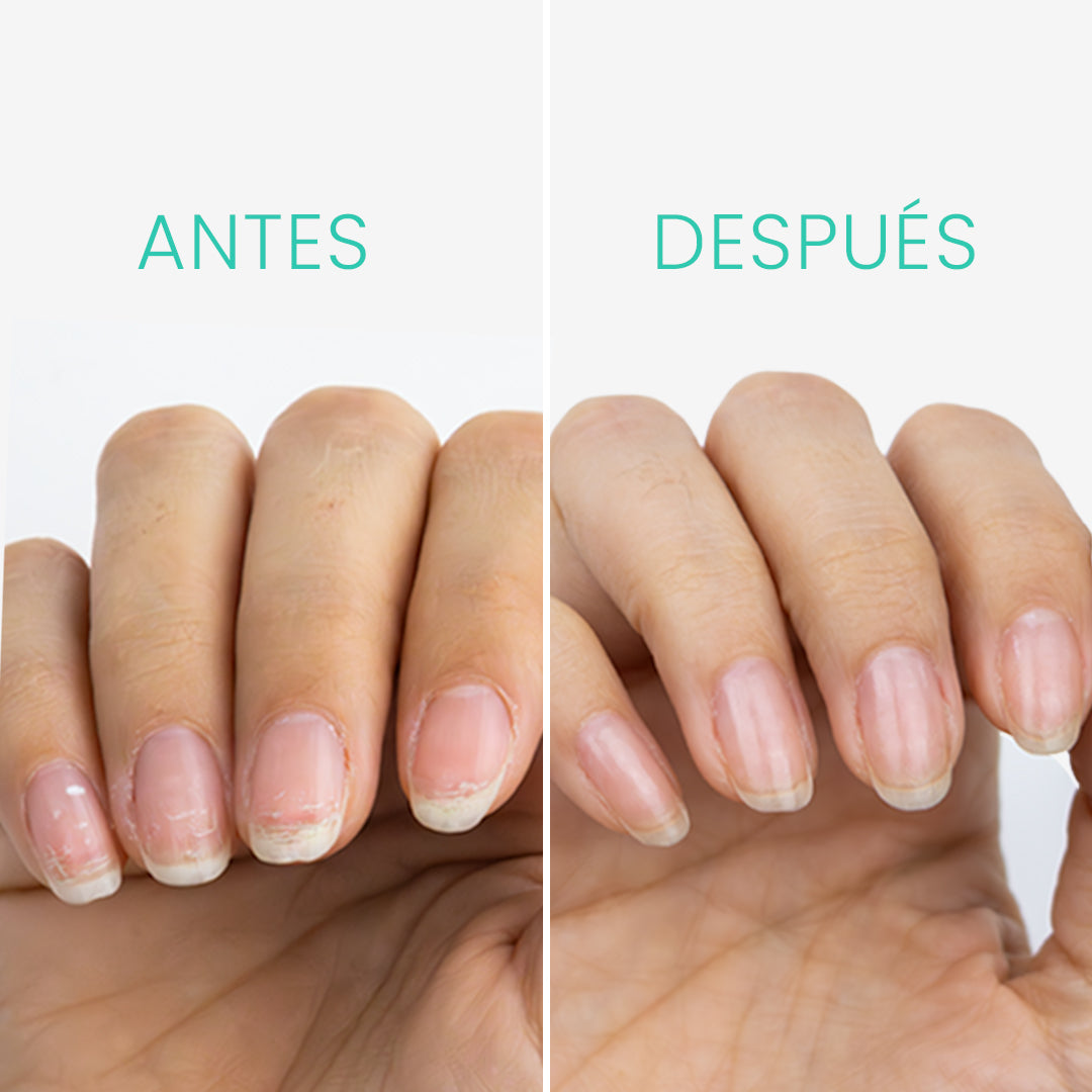 Base Reparadora